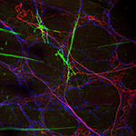 Image of the neuronal innervation of the gastrointestinal tract.