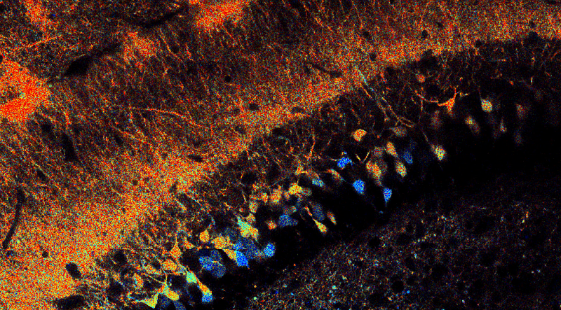 Hippocampal neurons expressing the metabolic sensor Peredox.