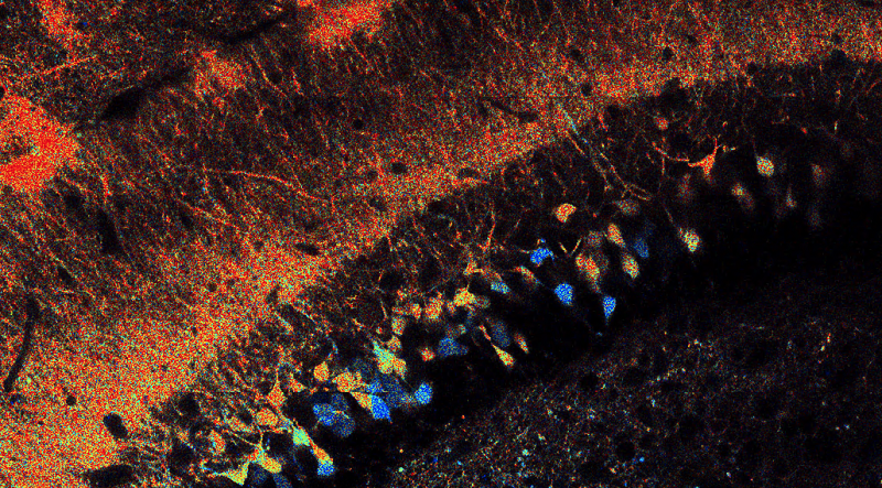 Hippocampal neurons expressing the metabolic sensor Peredox.