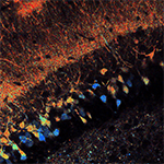 Hippocampal neurons expressing the metabolic sensor Peredox.