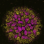 a brain organoid