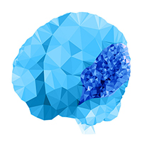 Polymicrogyria illustration