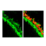 The regenerated hair cells (Green/Red double positive) were detected in the mouse cochleae after the cocktail/Ad.Atoh1 reprogramming.