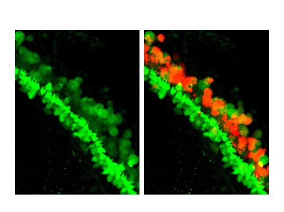 The regenerated hair cells (Green/Red double positive) were detected in the mouse cochleae after the cocktail/Ad.Atoh1 reprogramming.
