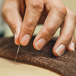 close up of a hand applying an accupuncture needle to a patient