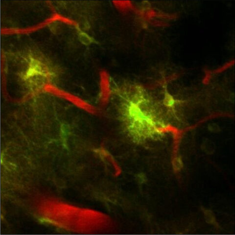 Astrocytic Hug by Aryan Rajput