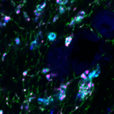 The image shows serotonin receptor expression on retinal axon terminals in the thalamus. Retinal axons are shown in green, the presynaptic terminals are shown in blue and the serotonin receptors in magenta.