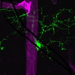 retinal-microglia-850 (https://hms.harvard.edu/sites/default/files/media/retinal-microglia-850.jpg)