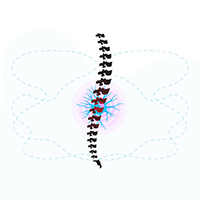 image illustrating spine pain