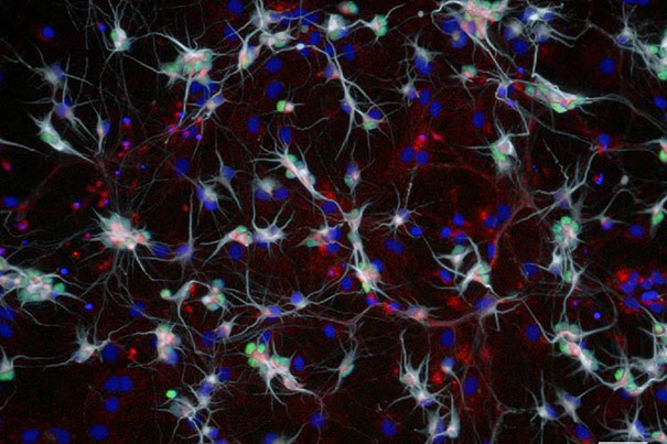 sma_human-motor-neurons_605