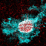 A microscope image of a specialized brain cell called an astrocyte.
