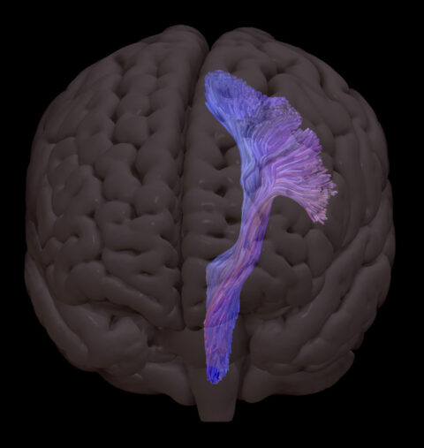 A Reconstructed Corticospinal Tract by Steven Meisler