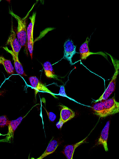 Neuronal Stem Cells Differentiating Into Neurons by Katharina Meyer