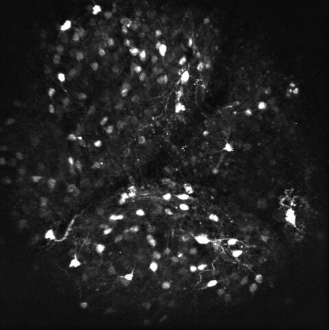 Medium Spiny Neurons in Ventral Striatum from a Behaving Mouse by Selina Qian