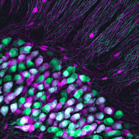 Spiral Ganglion Neuron Diversity by Isle Bastille