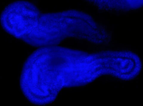 Pluripotent Stem Cell Derived Neural Tube-Like Organoids 2 by Dosh Whye