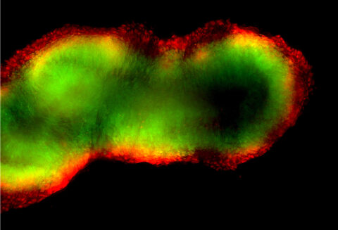 Human iPSC-derived Neuromesodermal Organoid by Delaney Wood