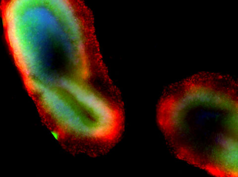 Human iPSC-derived Neuromesodermal Organoid by Delaney Wood
