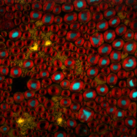 Multicolor Imaging of Peripheral Nerve by Iván Coto Hernández