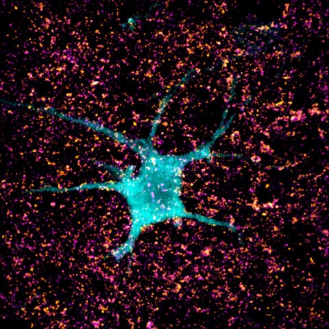 Spinal Cord Starry Night by Ilayda Alkislar