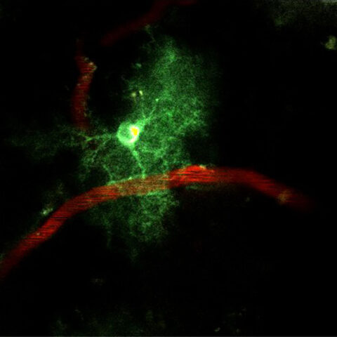 Astrocyte Perched on a Capillary in Awake Mouse Brain by Patricia Kelly