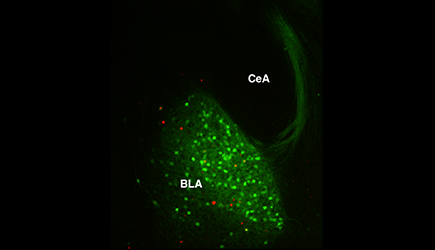 A section of brain tissue was obtained from a mouse expressing a fluorescent marker protein in Thy1 neurons (shown in green) after the mouse went through our behavioral experiments.