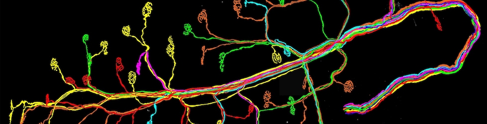 Support Brain Research Banner