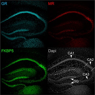 Immunofluorescence imaging of three key stress proteins in the mouse hippocampus