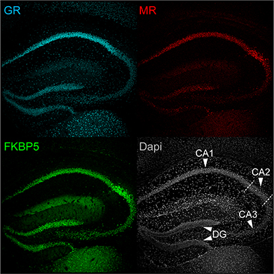 Immunofluorescence imaging of three key stress proteins in the mouse hippocampus