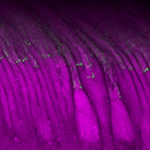 An experimental gene therapy raised levels of the key protein protocadherin-15, shown in green, in light-sensing cells in the retinas of nonhuman primates. Image: Maryna Ivanchenko
