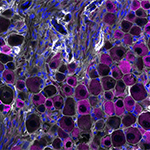 Clusters of mouse vagus nerve sensory cells reveal the presence of TRPV1, a molecular sensor that detects irritants, heat, and inflammation.