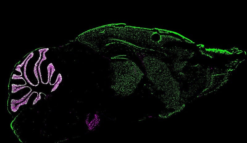 ?GABA expression throughout the brain (green) and a cerebellum-specific reporter (red).