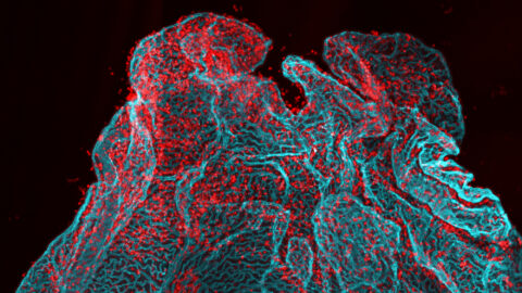Breaching of the Choroid Plexus Barrier by Huixin Xu