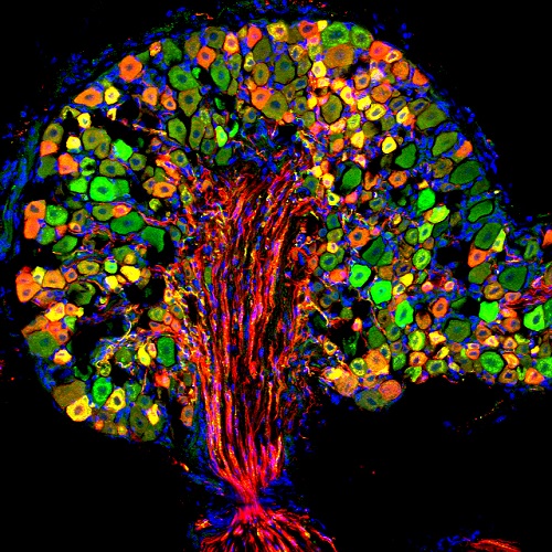 ImageJ=1.53funit=micronfinterval=1