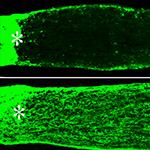 Axons (nerve fibers) regrowing through the injured optic nerve are visualized by green fluorescent staining