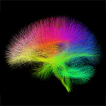 Image Mapping of Whole Brain White Matter Connections